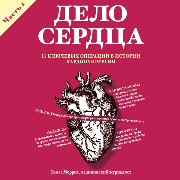 Дело сердца. 11 ключевых операций в истории кардиохирургии. Часть 1 - Моррис Томас